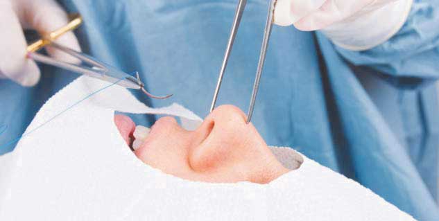  राइनोप्लास्टी