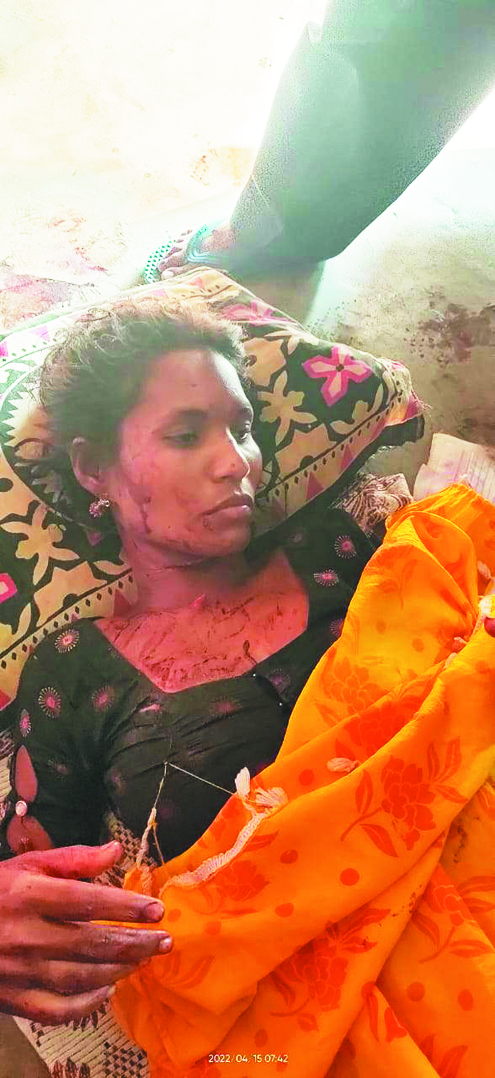 पत्नी और उसके प्रेमी पर किया चाकू से वार