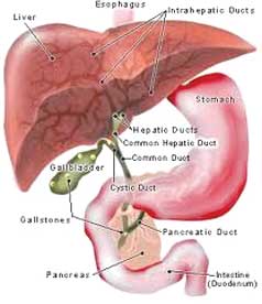 गुर्दे में पथरी कैसे हो जाती है?