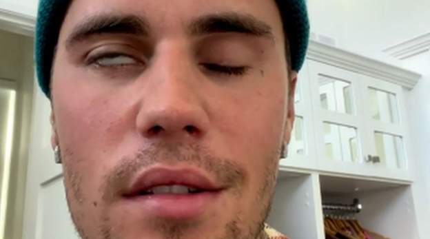 पॉप स्टार जस्टिन बीबर का चेहरा हुआ लकवाग्रस्त, शो किए रद्द