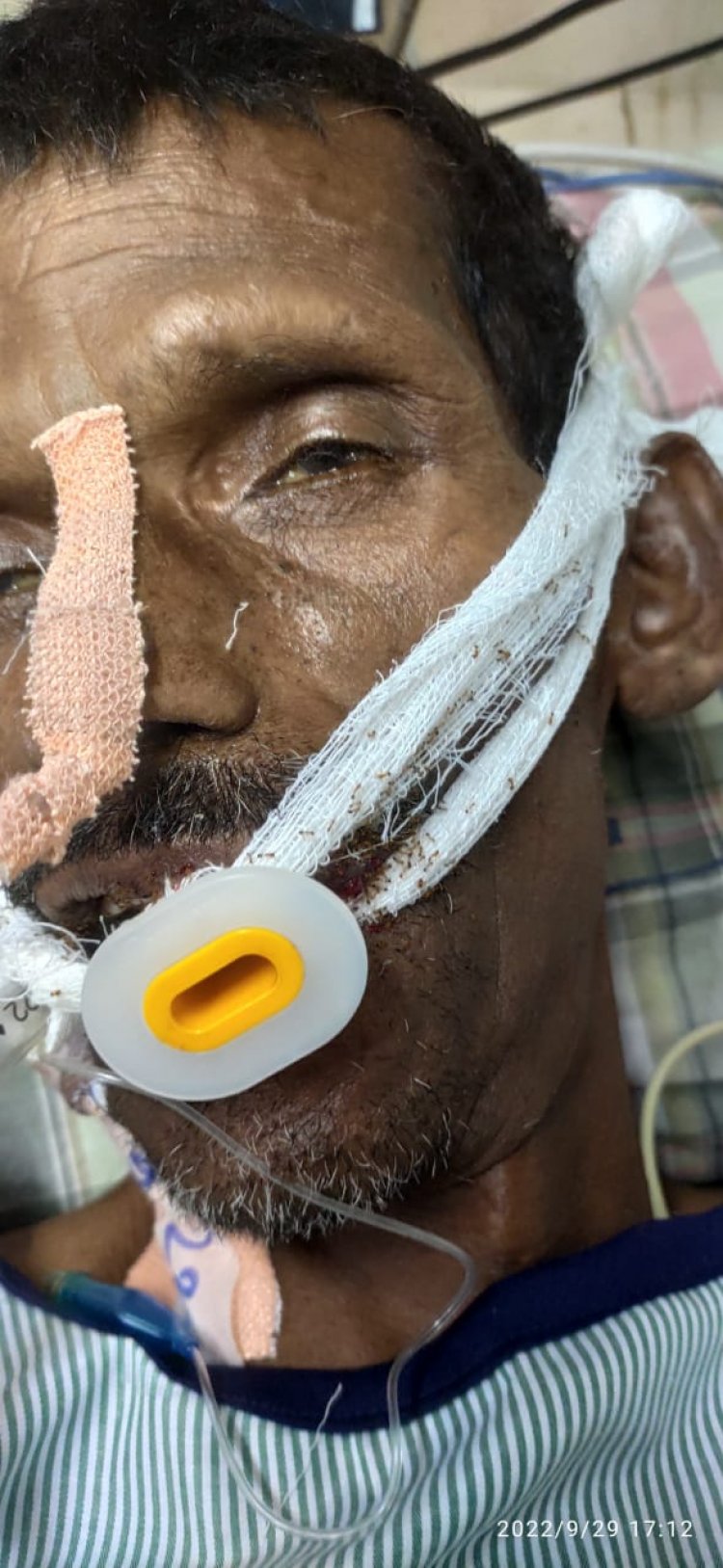 चंदूलाल अस्पताल में आईसीयू मरीज के चेहरे पर दौड़ रहीं थीं लाल चीटियाँ, आक्सीजन नली से रेंगती मरीज पर बना रही थीं कतार चंदूलाल अस्पताल में आईसीयू मरीज के चेहरे पर दौड़ रहीं थीं लाल चीटियाँ, आक्सीजन नली से रेंगती मरीज पर बना रही थीं कतार