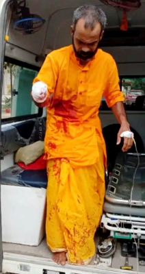 अयोध्या में साधु ने अपनी हथेली काटकर दुर्गा की मूर्ति के आगे चढ़ा दी