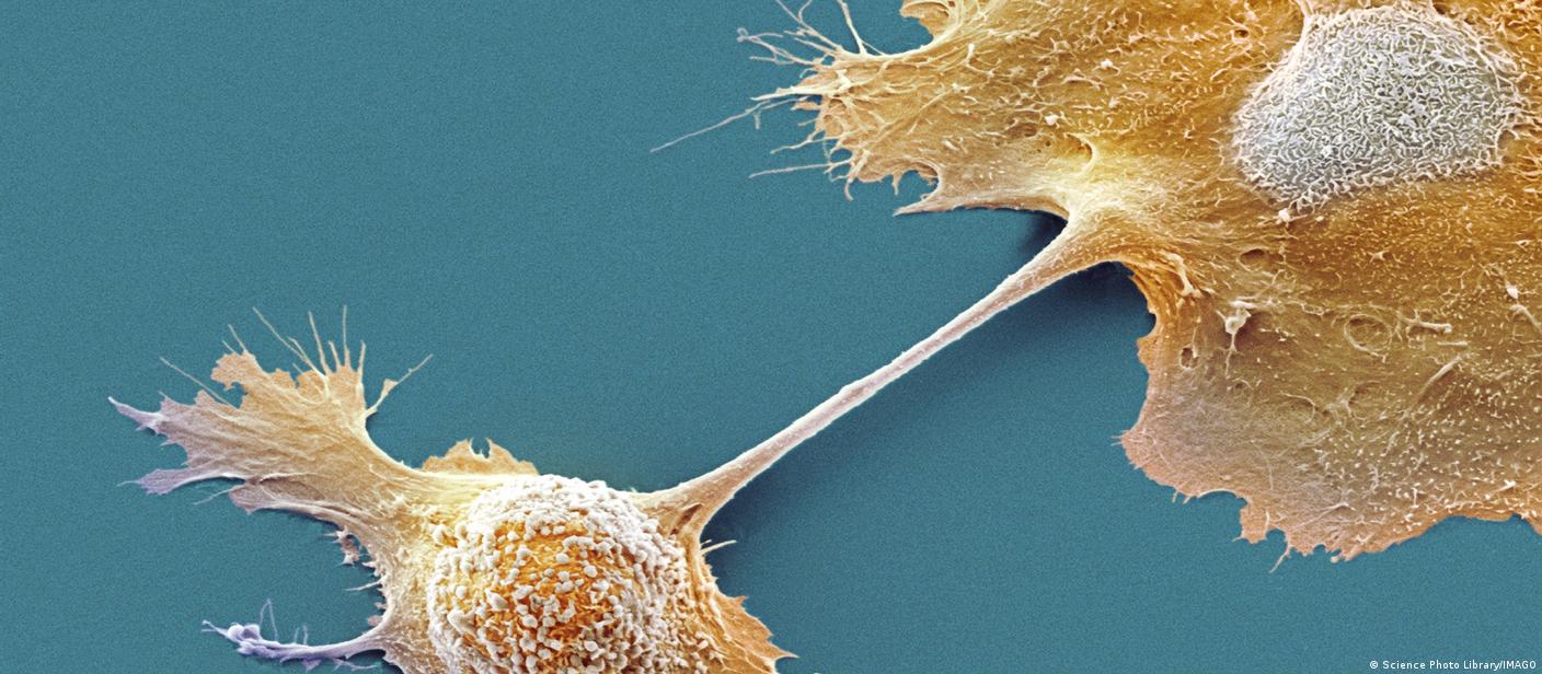 क्या आ गया है पेंक्रियाटिक कैंसर से बचाव का टीका?