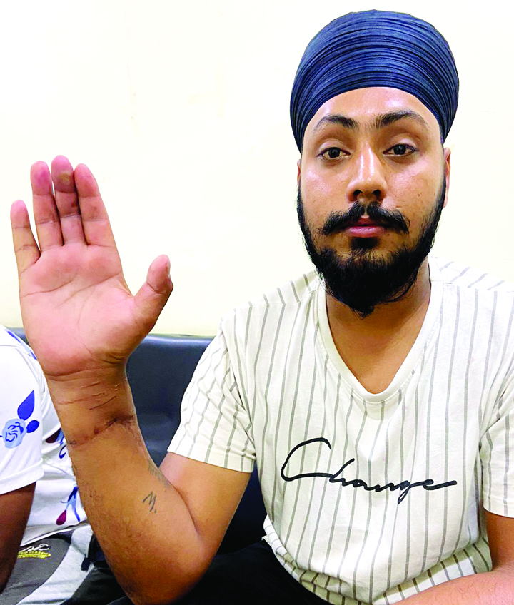 छह महीनों पहले कटी थी नस, ओम हॉस्पिटल में इलाज से हाथ कामगार छह महीनों पहले कटी थी नस, ओम हॉस्पिटल में इलाज से हाथ कामगार