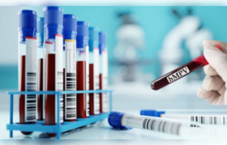 बेंगलुरु में एचएमपीवी : कर्नाटक सरकार ने कहा, यह भारत में पहले मामले नहीं 