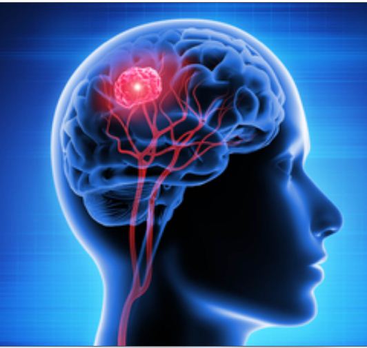 ट्रॉमैटिक ब्रेन इंजरी से पुरुषों की ज्यादा जाती है जान : शोध 