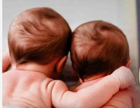 पहले की तुलना में क्यों ज्यादा पैदा हो रहे हैं जुड़वां बच्चे