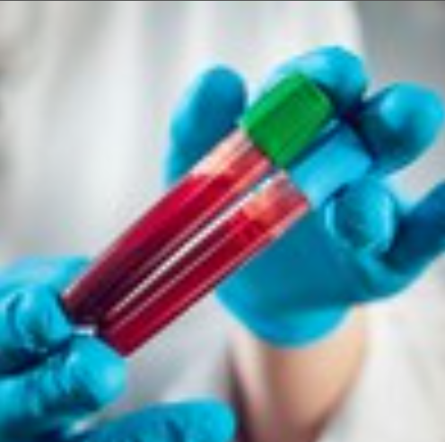 नए रक्त परीक्षण से अब जानलेवा ब्लड कैंसर का जल्दी पता लगेगा : अध्ययन 