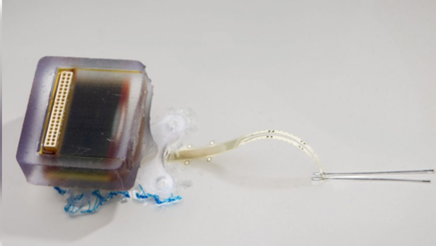 रीढ़ की हड्डी की चोट के इलाज में नई उम्मीद : शोधकर्ताओं ने विकसित किया इम्प्लांटेबल डिवाइस