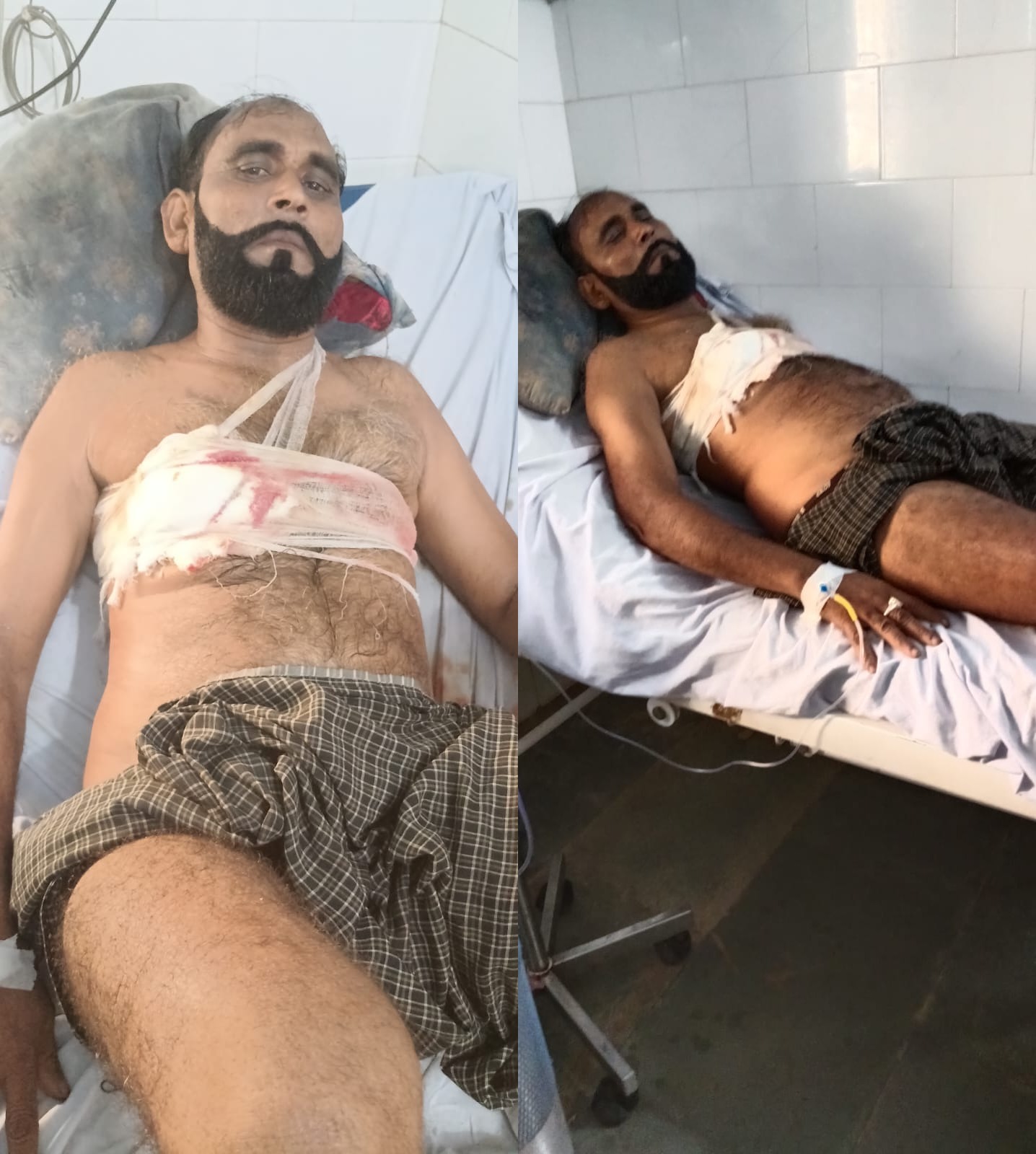  नवागढ़, भतीजे ने चाचा पर धारदार हथियार से हमला