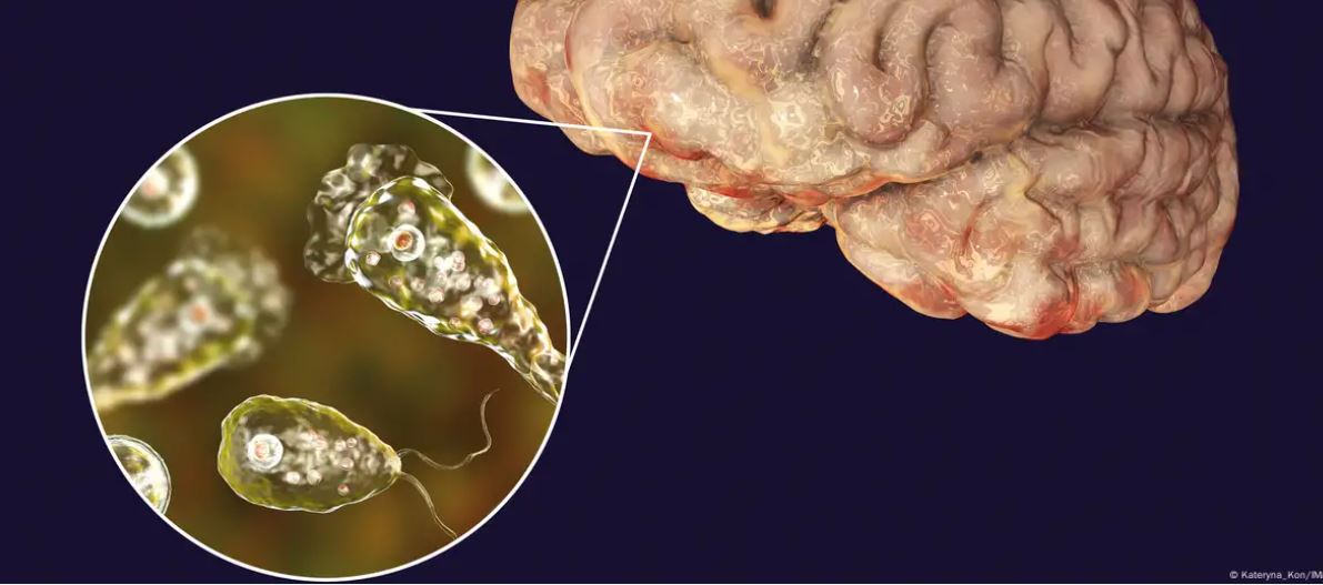 क्या ब्रेन ईटिंग अमीबा सच में खा जाता है इंसानों का दिमाग