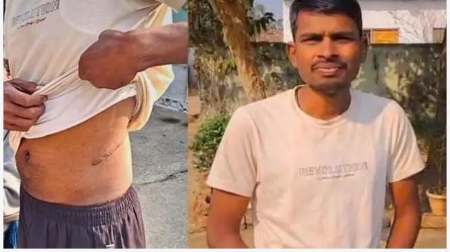 एक लाख का कर्ज़ हो गया 50 लाख, ज़मीन-जेवर बिके और किडनी भी बेचनी पड़ी