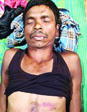 सोते बड़े भाई की हत्या, आरोपी फरार