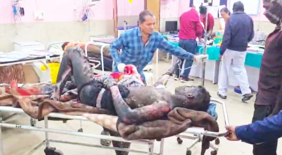 टायर फैक्ट्री में विस्फोट, 8 मजदूर झुलसे