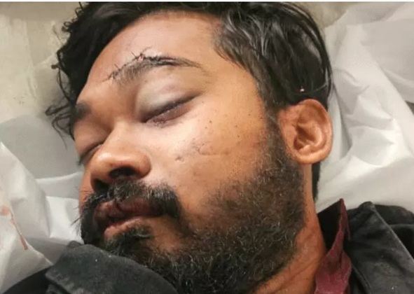 ट्रक चालक और ठेकेदार पर गैर इरादतन हत्या का केस