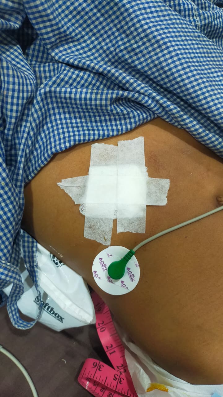 पुराने विवाद के चलते नाबालिग पर चाकू से हमला 