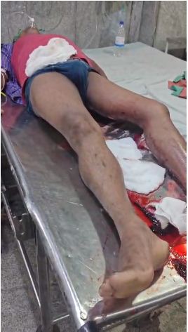 कैटरिंग का काम कर लौट रहे युवक को चाकू मारकर लूटा