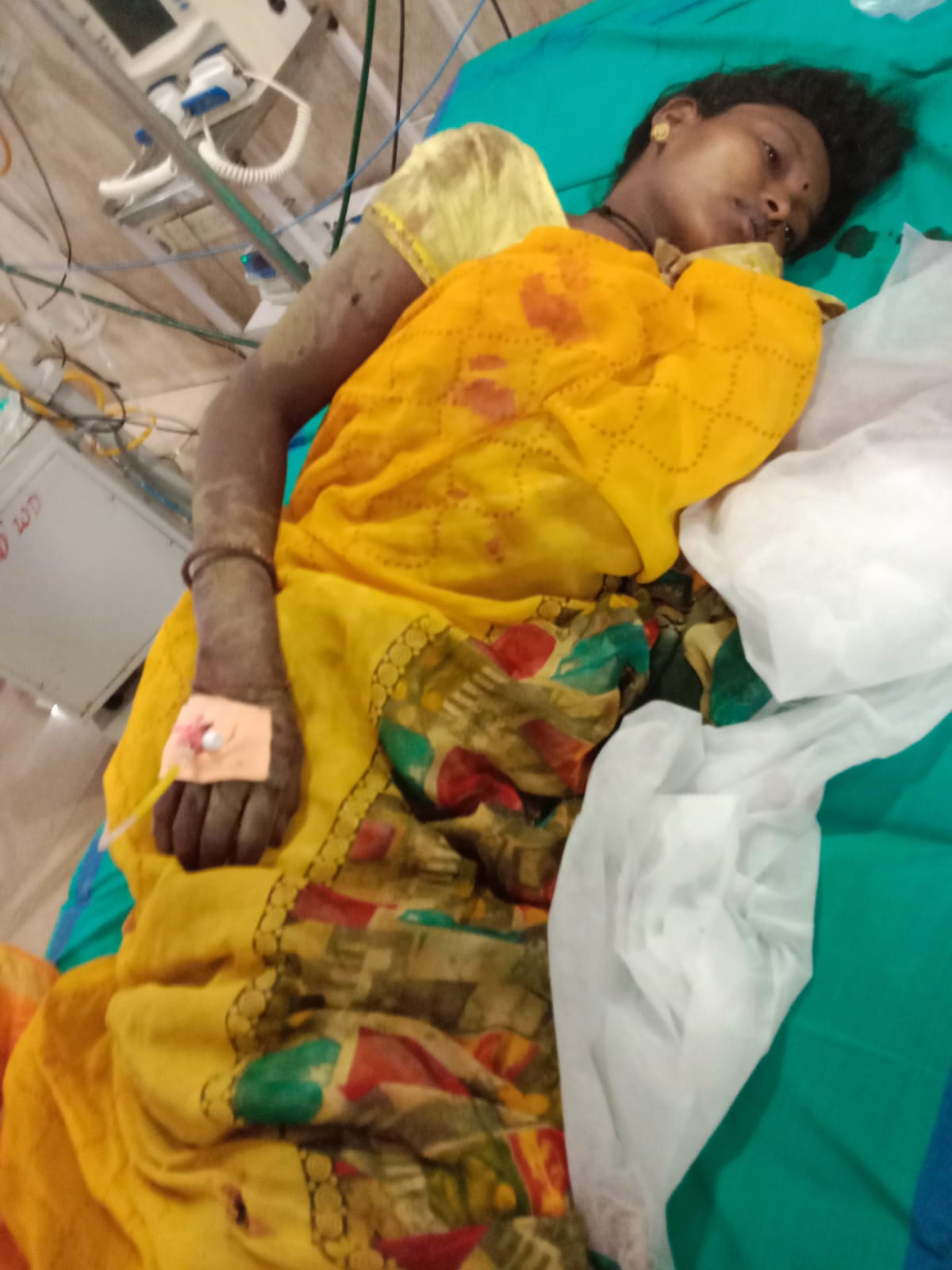 तेन्दूपत्ता तोड़ाई में जुटे मजदूरों पर जंगली सुअरों का हमला, आधा दर्जन गंभीर