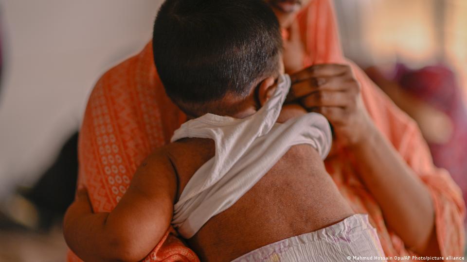 बांग्लादेश में खसरे का कहर: 500 से अधिक बच्चों की मौत, डब्ल्यूएचओ से जांच की मांग