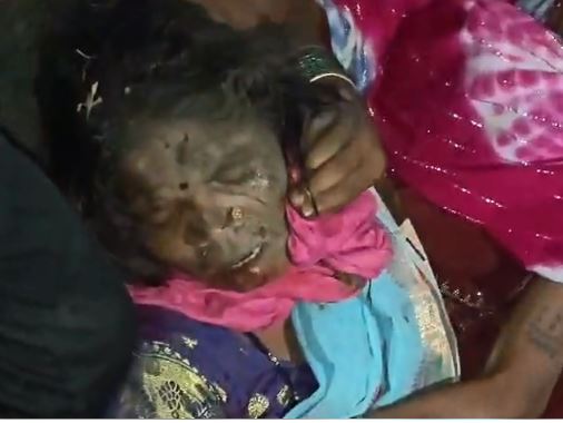 शादी में शामिल होने आई महिला सूखे कुएं में गिरी, ग्रामीणों ने सुरक्षित निकाला