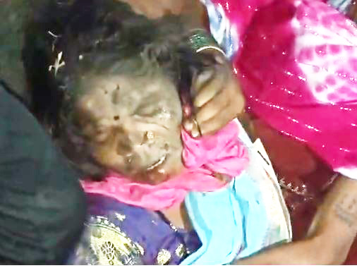 शादी में शामिल होने आई महिला सूखे कुएं में गिरी, ग्रामीणों ने सुरक्षित निकाला