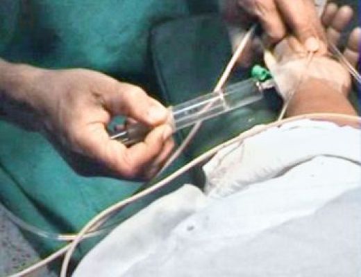 नारको टेस्ट क्या है?