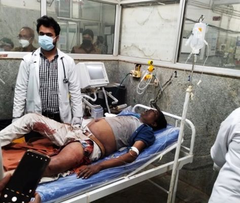 हावड़ा मेल में चढ़ने की कोशिश करते गिरा युवक बोगियों के बीच फंसा, हाथ कटा