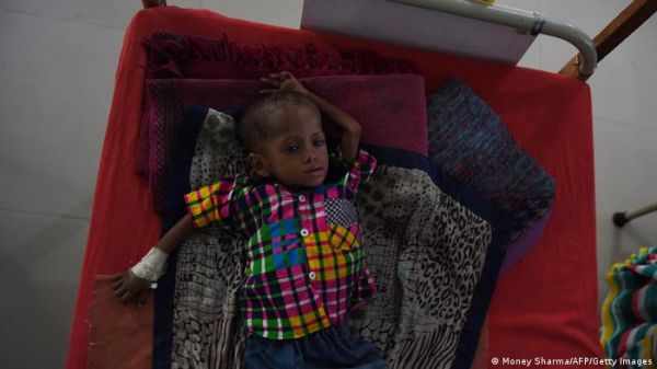 महाराष्ट्र में कुपोषण से तीन सालों में 6,852 बच्चों की मौत