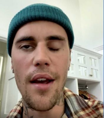 Ramsay Hunt Syndrome: जस्टिन बीबर को आख़िर क्या बीमारी है