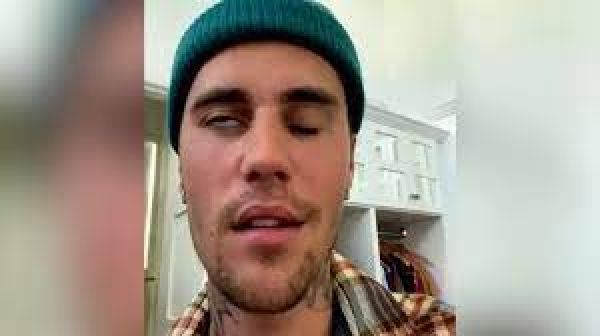 जस्टिन बीबर ने अपने चेहरे के पक्षाघात को लेकर ताजा जानकारी साझा की