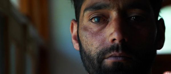 रबर की गोलियां ले रही हैं लोगों की जानेंः एमनेस्टी