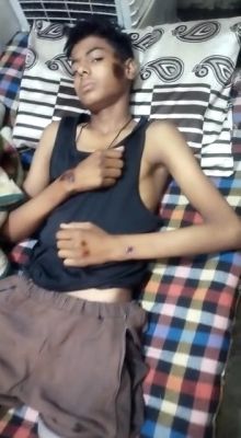 कार ने लड़के को मारी टक्कर, घसीटा