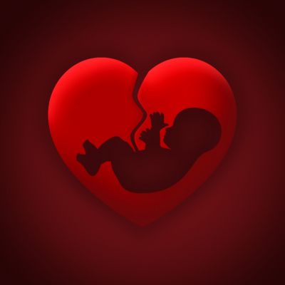 फ्रांस में गर्भपात कराना संवैधानिक अधिकार बना, राष्ट्रपति ने कहा- पूरी दुनिया के लिए संदेश