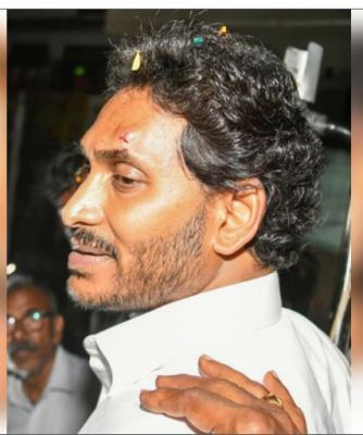 वाईएसआर कांग्रेस ने जगन पर हमले के लिए टीडीपी को जिम्मेदार ठहराया