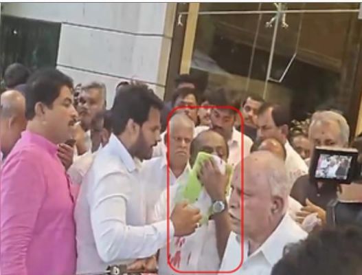 नाक से खून बहने के बाद एच.डी. कुमारस्वामी अस्पताल में भर्ती, मिली छुट्टी 