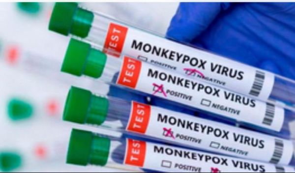 अफ्रीका में एमपॉक्स के प्रकोप को रोकने के लिए वैक्सीन की खरीद जरूरी : रिपोर्ट 