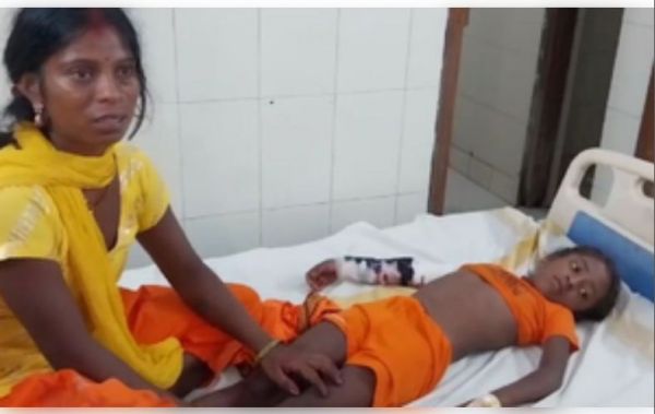 नेपाल से देवघर जाने वाली बस को ट्रक ने मारी टक्कर, 35 यात्री घायल 