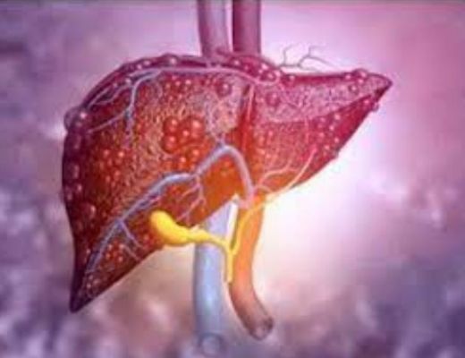 मोटापे और शुगर से लिवर कैंसर दोबारा होने का खतरा बढ़ जाता है: शोध 