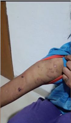 नाबालिग नौकरानी को पीटा, बच्ची को पुलिस ने कराया मुक्त, मुकदमा दर्ज 