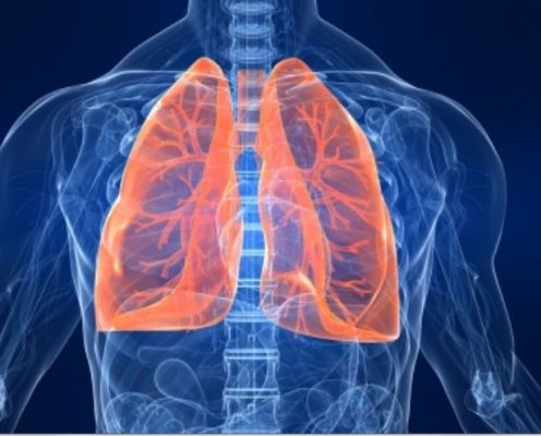 फेफड़ों की बीमारी के रोगियों में सामान्य फंगल संक्रमण भी हो सकता है घातक : एम्स अध्ययन