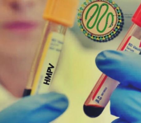 एचएमपीवी को लेकर सिक्किम सरकार ने जारी की हेल्‍थ एडवाइजरी 