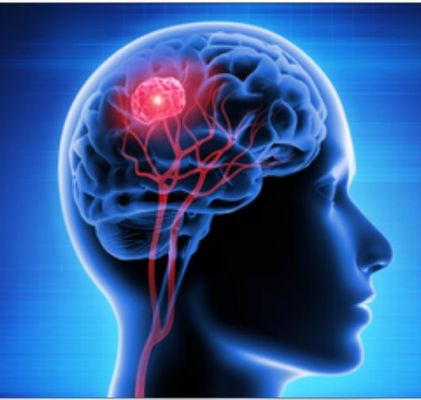 ट्रॉमैटिक ब्रेन इंजरी से पुरुषों की ज्यादा जाती है जान : शोध 