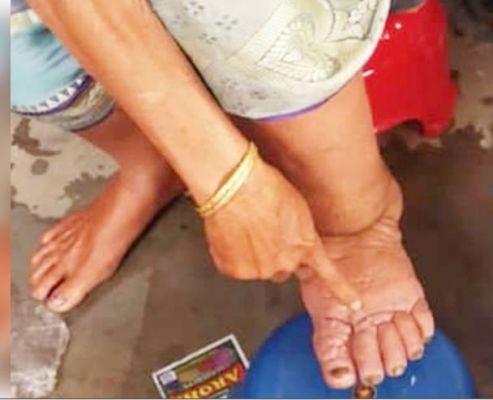 लखनऊ : फाइलेरिया रोधी अभियान में कम्युनिटी रेडियो निभाएंगे अहम भूमिका 