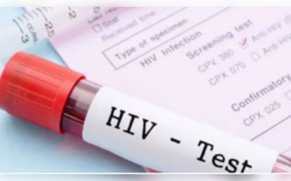 एचआईवी से पीड़ित लोगों के लिए कम आंका गया है हृदय संबंधी जोखिम : अध्ययन 