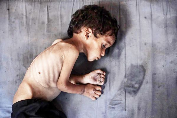 गाजा अकाल : हवाई हमले में मारा जाना अपने बच्चों को भूख से मरते देखने से कहीं ज़्यादा आसान है