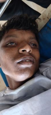 आपसी रंजिश में युवक का किडनैप, बेरहमी से पिटाई के बाद मौत