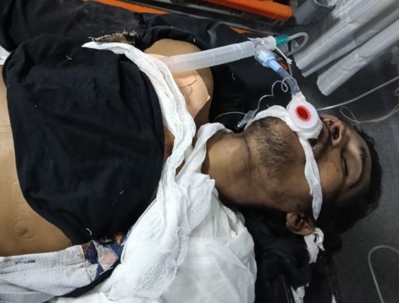 देवेन्द्र नगर में ई रिक्शा की ठोकर से युवक की मौत