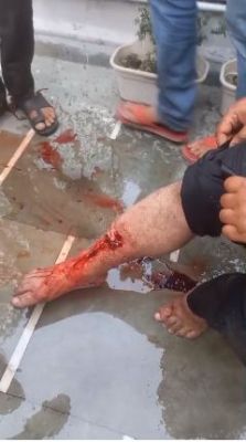 अनुपम नगर में पिटबुल कुत्ते ने युवक को काट लिया