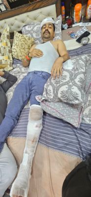 आप पार्टी के कार्यकारी प्रदेश अध्यक्ष जायसवाल घायल 