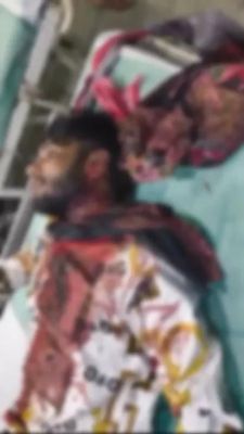 बैरनबाजार में सरेराह चाकू बाजी, आदतन बदमाश ने काटा कान, गले पर भी हमला 